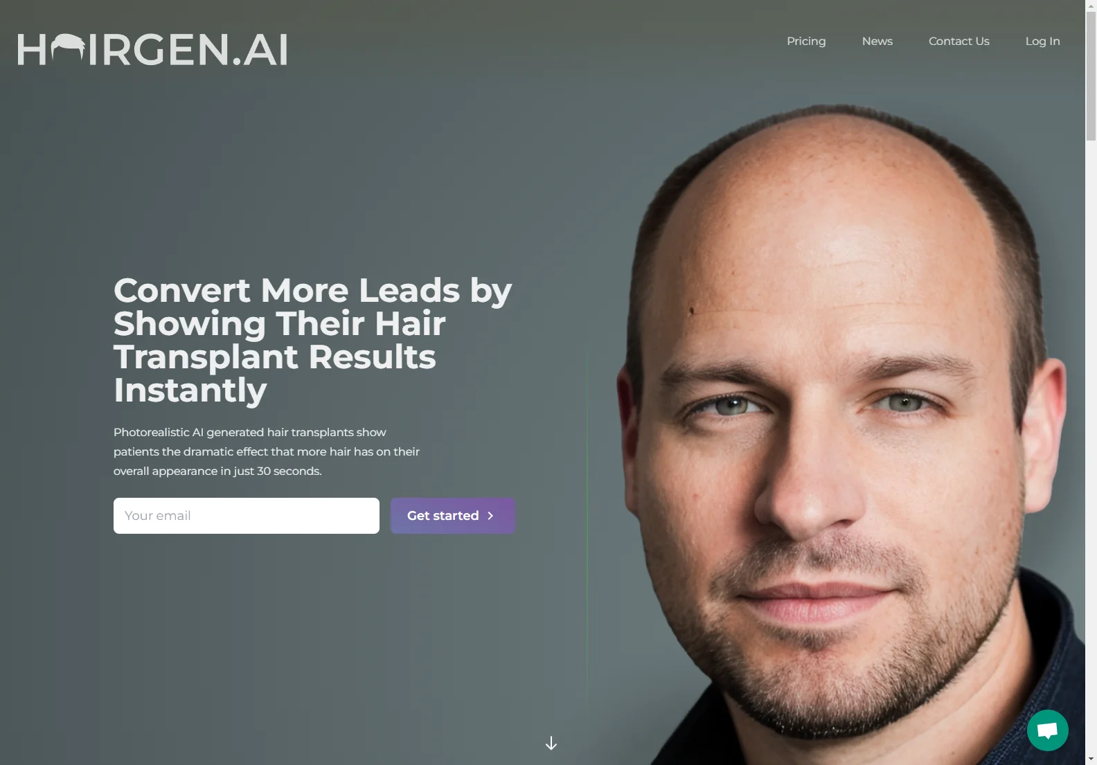 Preview Your Hair Transplant with AI: The Power of Hairgen.ai