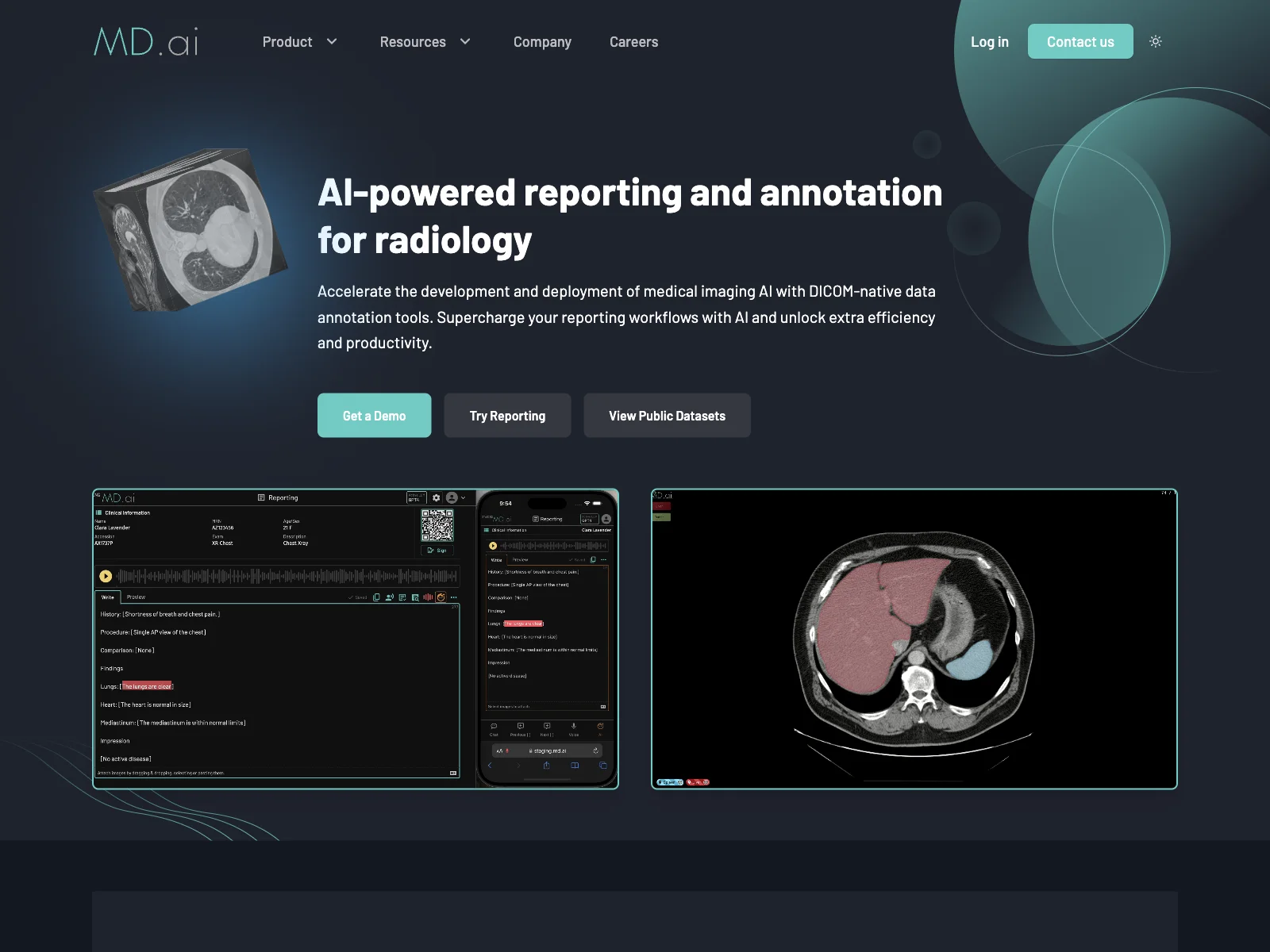 MD.ai: Enhancing Radiology with AI-Powered Reporting & Annotation