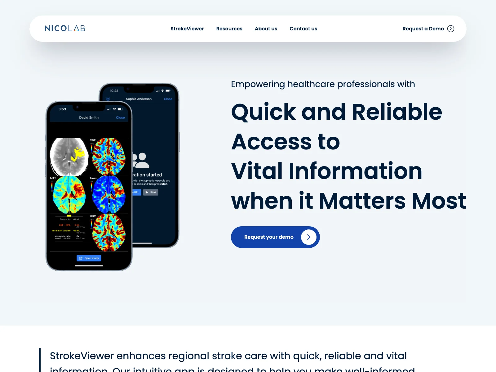 Enhance Stroke Care with StrokeViewer - A Revolutionary AI Assistant